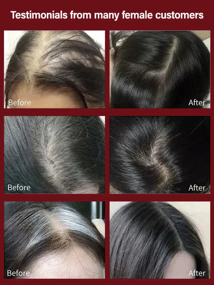 Relaxing Laser Hair Comb